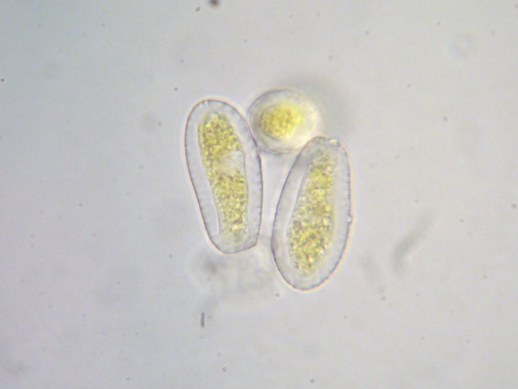 Puccinia-pseudosphaeria_Sonchus-arvensis