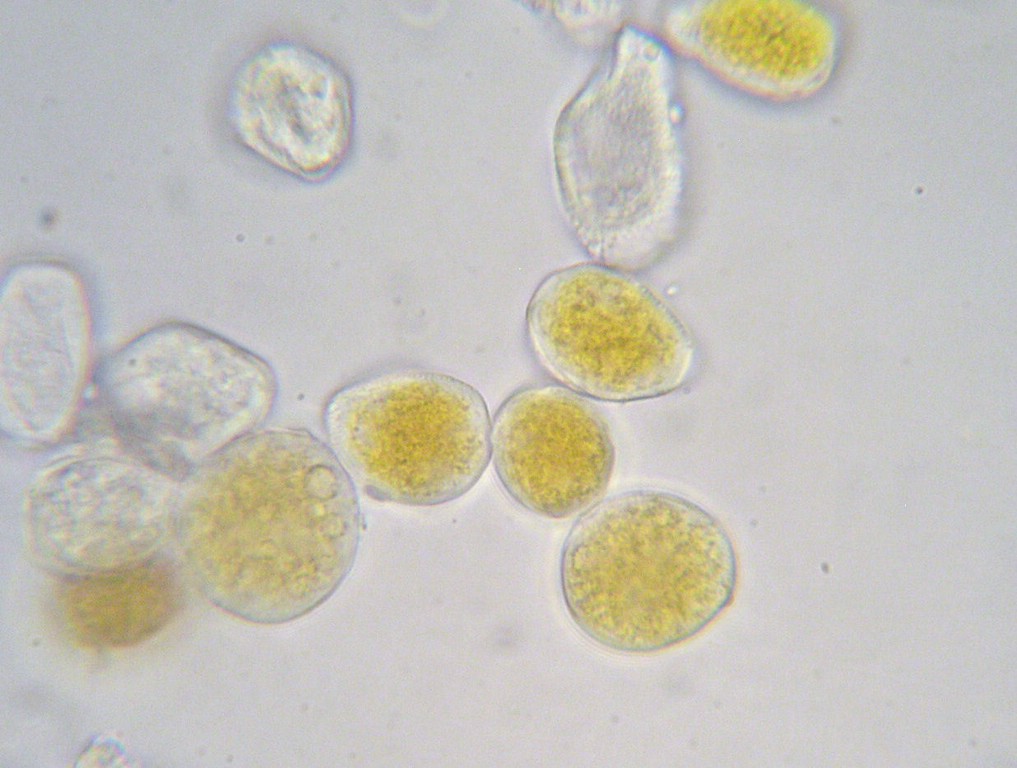 Puccinia-pulverulenta_Epilobium-hirsutum