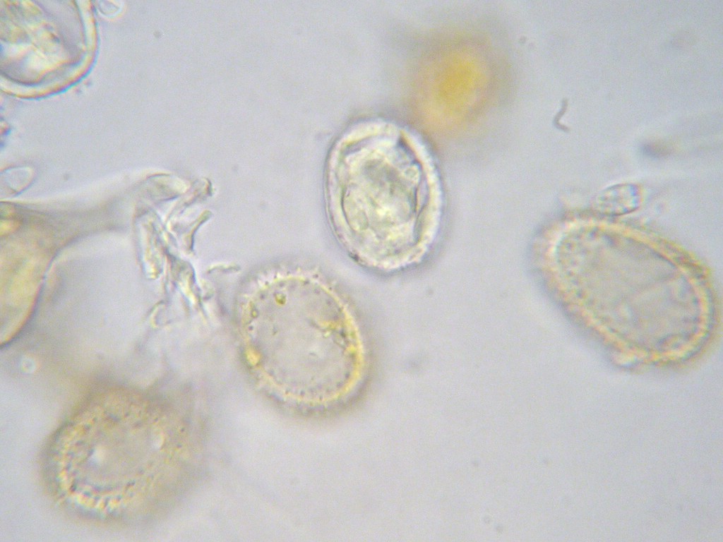 Puccinia-pygmaea_Calamagrostis-villosa