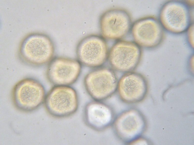 Tranzschelia prunispinosae (Obligat) Phytoparasitische Kleinpilze